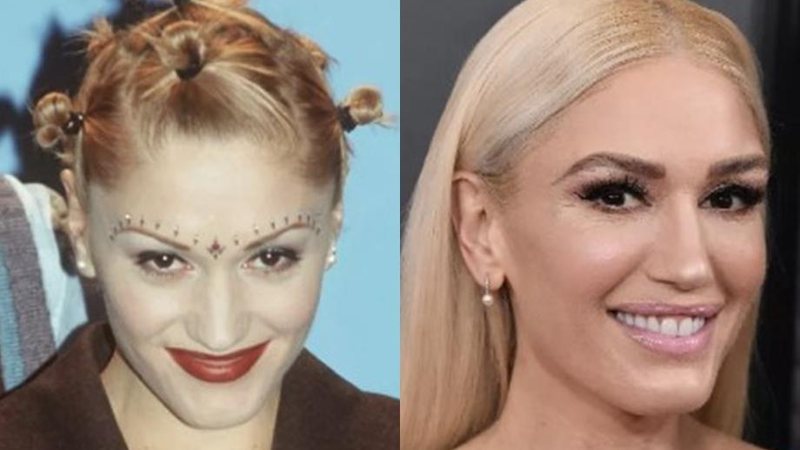 Gwen Stefani surge com rosto diferente e fãs protestam: “99% preenchimento, 1% pele” - Foto: Reprodução