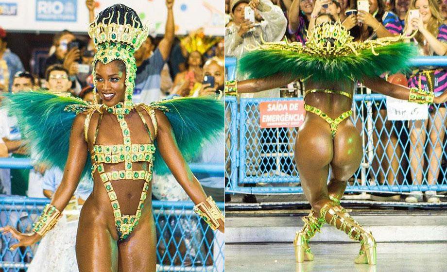 Cenapop · Modelo viraliza ao exibir corpo real com estrias e celulites em  desfile: “Linda e natural”
