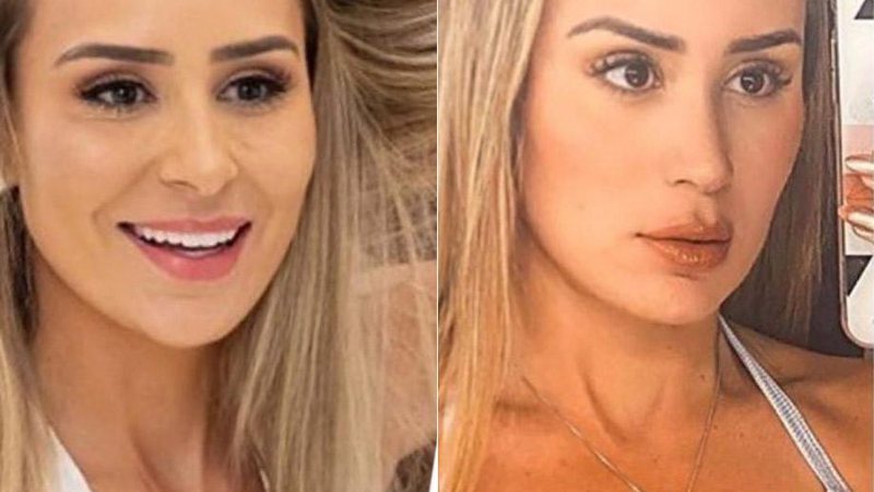 Letícia Santiago antes e um mês após a cirurgia plástica no nariz - Foto: Reprodução/ Instagram