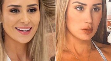 Letícia Santiago antes e um mês após a cirurgia plástica no nariz - Foto: Reprodução/ Instagram