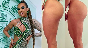 Leticia Guimarães mostrou antes e depois do bumbum após procedimento - Foto: Reprodução/Instagram@leticiaguimaraesrainha