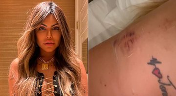 Liziane Gutierrez quebrou uma das costelas após briga por ciúmes - Foto: Reprodução/ Instagram@liziane_gutierrez