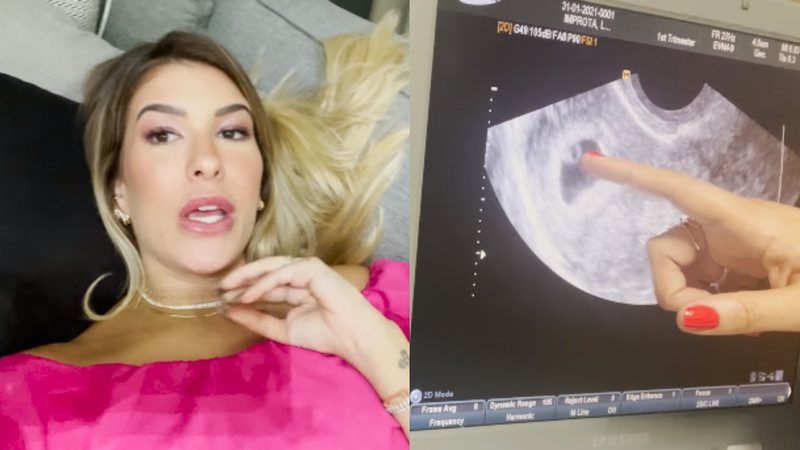 Lore Improta fez seu primeiro ultrassom em casa - Foto: Reprodução / YouTube