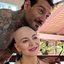 Karina Lucco falou sobre o tratamento após diagnóstico de alopecia