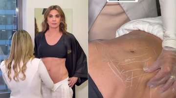 Luciana Gimenez mostrou procedimento de beleza para “recuperar abdômen”