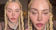 Alguns usuários ainda ironizaram cantora e ressaltaram sobre o excesso de procedimentos estéticos - Foto: Reprodução / TikTok @madonna