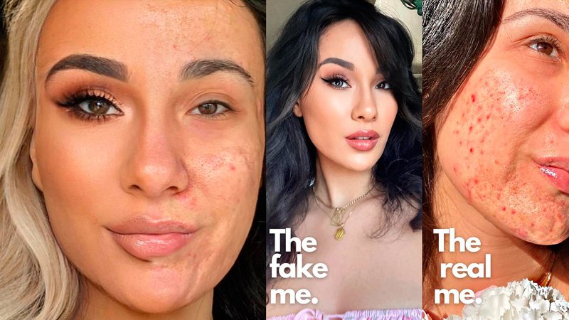 Maia Gray surpreendeu ao mostrar rosto metade maquiado e metade com acne - Foto: Reprodução/ Instagram@its_just_acne