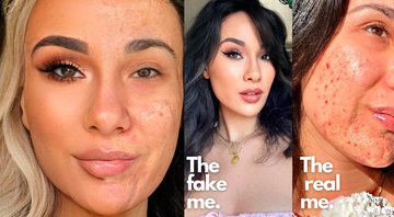 Maia Gray surpreendeu ao mostrar rosto metade maquiado e metade com acne - Foto: Reprodução/ Instagram@its_just_acne