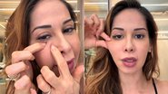 Maíra Cardi contou que fará cirurgia para retirar PMMA do rosto