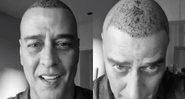 Ator contou que sentia os fios de cabelo caindo há cerca de três anos - Foto: Reprodução / Instagram