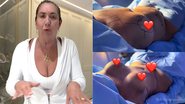 Margareth Serrão falou sobre combo de cirurgias plásticas
