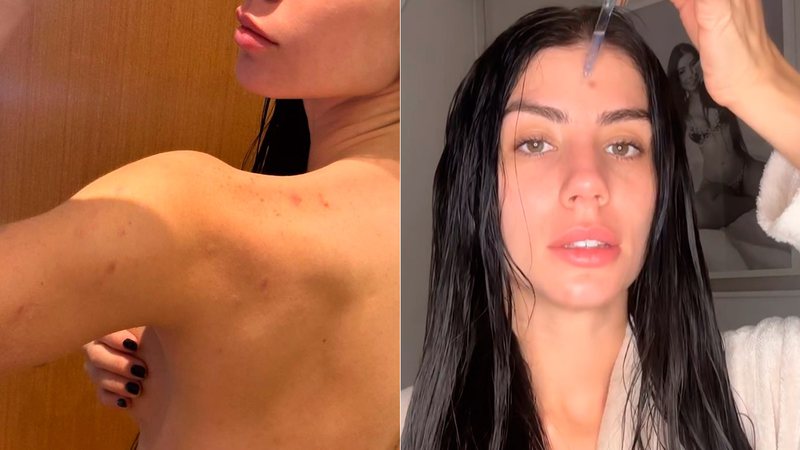 Maria Lina posou de topless e mostrou espinhas pelo corpo - Foto: Reprodução/ Instagram@marialdgg