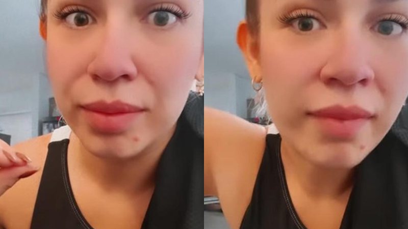 Marília Mendonça desabafa em seu Instagram sobre as acnes que apareceram em seu rosto - Foto: Reprodução / Instagram @mariliamendoncacantora
