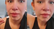 Marília Mendonça desabafa em seu Instagram sobre as acnes que apareceram em seu rosto - Foto: Reprodução / Instagram @mariliamendoncacantora