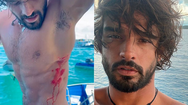 Marlon Teixeira se machucou durante o surfe na Indonésia - Foto: Reprodução/ Instagram@marlontx