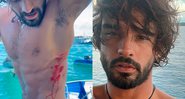 Marlon Teixeira se machucou durante o surfe na Indonésia - Foto: Reprodução/ Instagram@marlontx