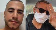 Diversos artistas já realizaram implante ou transplante capilar para combater a calvície - Reprodução/Instagram/@uaimatheus