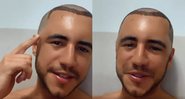 Ex-BBB contou que percebeu os primeiros indícios de inchaço na cabeça - Reprodução/Instagram/@uaimatheus