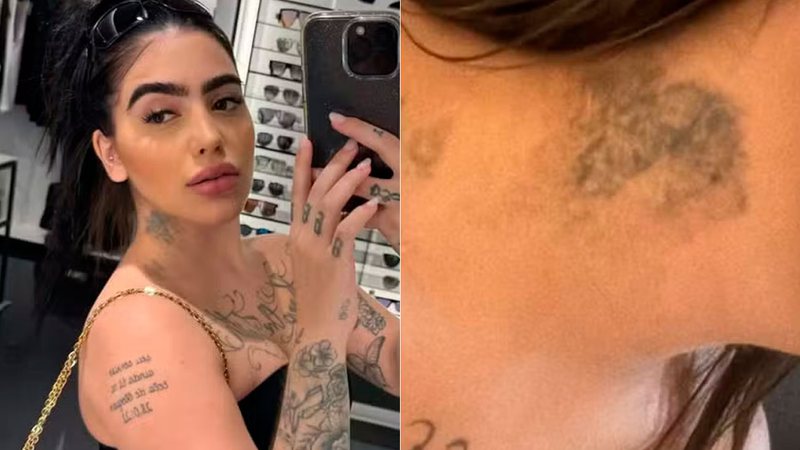 MC Mirella mostrou marca no pescoço de tatuagem que está removendo - Foto: Reprodução/ @xbadmix
