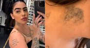 MC Mirella mostrou marca no pescoço de tatuagem que está removendo - Foto: Reprodução/ Instagram@xbadmix