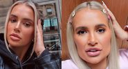 Molly lamentou pelo excesso de procedimento estético - Reprodução/Instagram