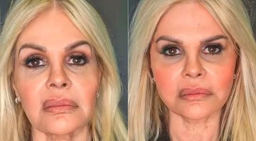 Monique Evans mostrou antes e depois de harmonização facial - Foto: Reprodução/ Instagram@moniquevansreal