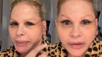 Monique Evans disse que teve problemas com o aplicativo do banco após cirurgia facial