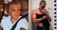 Nick Cruz falou sobre cirurgia de mastectomia - Foto: Reprodução/ Instagram@nickcruz