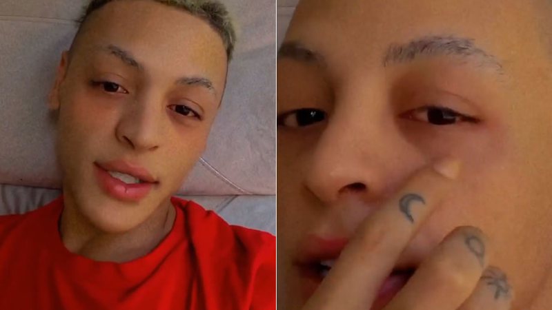 Pabllo Vittar precisou cancelar live de maquiagem por causa de alergia nos olhos - Foto: Reprodução/ Instagram