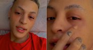 Pabllo Vittar precisou cancelar live de maquiagem por causa de alergia nos olhos - Foto: Reprodução/ Instagram