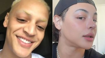 Pabllo Vittar impressiona ao mostrar resultado de rinoplastia: veja o antes e depois