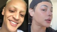 Pabllo Vittar mostrou resultado de sua 3ª rinoplastia