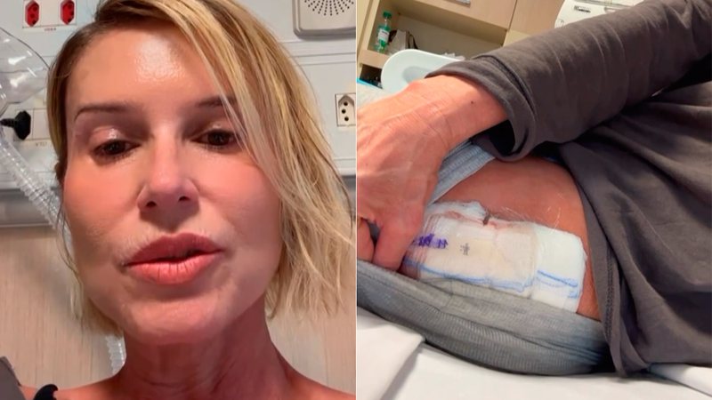 Paula Burlamaqui mostrou curativo após cirurgia no quadril - Foto: Reprodução/ Instagram@paulaburlamaquioficial