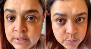 Preta Gil exibiu rosto sem filtro e pediu cautela na web - Foto: Reprodução/ Instagram