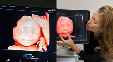 Gabriela Pugliesi compartilha novo ultrassom de seu filho - Foto: Reprodução / Instagram