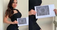 Raissa Barbosa mostrou raio-x que fez para provar que seu bumbum e natural - Foto: Reprodução/ Instagram