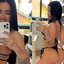 Raíssa Souza mostrou antes e depois do bumbum após procedimento - Foto: Arquivo pessoal