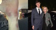 James Heerdegen, Christina Ricci, e os hematomas em seu braço - Reprodução/TMZ, Getty Images