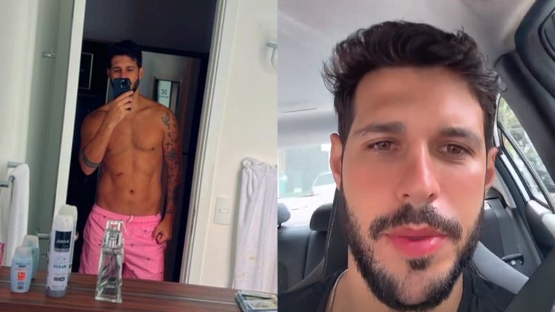 Rodrigo Mussi mostrou a queimadura em sua barriga através de selfie no espelho - Foto: Reprodução / Instagram