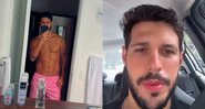 Rodrigo Mussi mostrou a queimadura em sua barriga através de selfie no espelho - Foto: Reprodução / Instagram