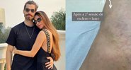 Romana Novais fala sobre tratamento após gestações - Foto: Reprodução / Instagram @romananovais