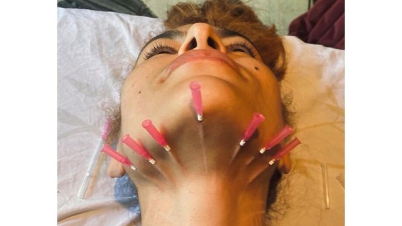 Atriz mostra tratamento chocante que fez em spa - Reprodução/Instagram