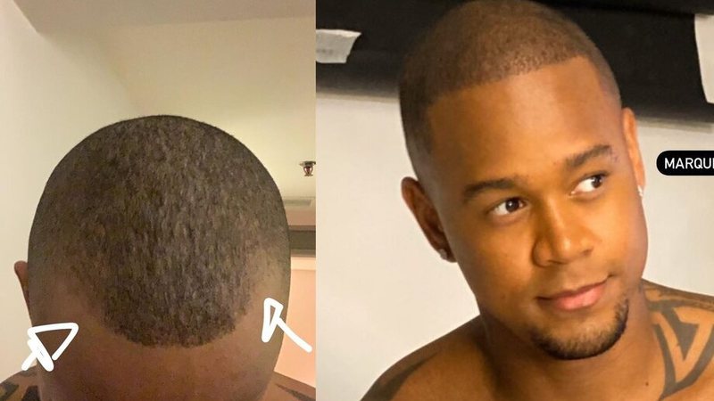 Léo Santana antes e depois do tratamento - Foto: Reprodução/ Instagram@leosantana