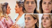 Naiara Azevedo usou seu Instagram para mostrar comparação do rosto da mãe após procedimento - Reprodução/Instagram