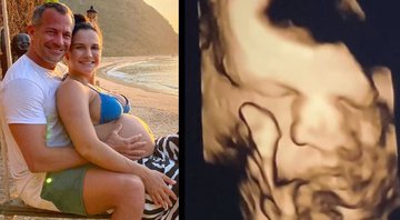 Malvino mostrou a mulher, Kyra Gracie, fazendo ultrassom do filho, Ryan - Reprodução/Instagram