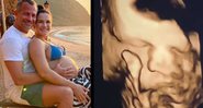 Malvino mostrou a mulher, Kyra Gracie, fazendo ultrassom do filho, Ryan - Reprodução/Instagram