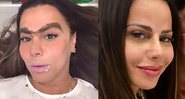 Viviane publicou stories falando sobre micropigmentação na sobrancelha e nos lábios - Reprodução/Instagram