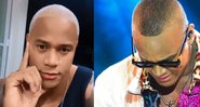 Leo Santana publicou fotos de antes de realizar o procedimento e como ficou depois - Reprodução/Instagram
