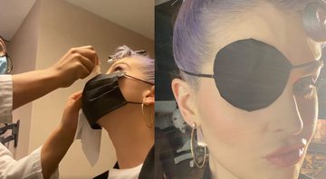 Kelly Osbourne teve que usar tampão após lesão no olho - Reprodução/Instagram