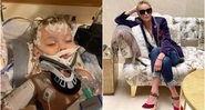 Imagem Sobrinho de Sharon Stone morre aos 11 meses, vítima de falência múltipla de órgãos